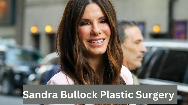 sandra bullock plastic surgery