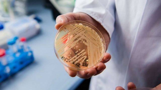 The Potentially Lethal Fungus Candida Auris is Rapidly Spreading Across the United States